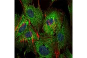 Immunofluorescence analysis of MSCS cells using BIRC5 mouse mAb (green). (Survivin 抗体)