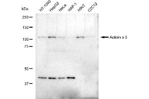 Western blotting analysis using Actinin alpha 3 antibody (ABIN7797473).