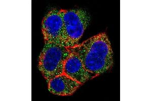 Immunofluorescence (IF) image for anti-Amylo-alpha-1, 6-Glucosidase, 4-alpha-Glucanotransferase (AGL) (AA 1479-1510), (C-Term) antibody (ABIN389030)