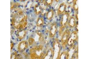 Used in DAB staining on fromalin fixed paraffin-embedded Kidney tissue (CCL8 抗体  (AA 1-99))