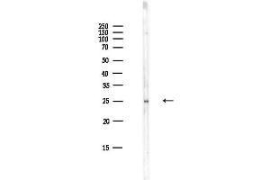 Western blot analysis of lysates from HepG2 cells(LPS,4h treatment), using Phospho-HSP27 (Ser82) Antibody at 1/1000 dilution.