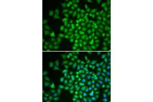 Immunofluorescence analysis of HeLa cells using COPS5 antibody. (COPS5 抗体  (AA 1-334))