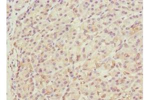 Immunohistochemistry of paraffin-embedded human pancreatic tissue using ABIN7172143 at dilution of 1:100 (THADA 抗体  (AA 1684-1953))