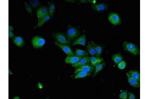 Immunofluorescent analysis of HepG2 cells using ABIN7156659 at dilution of 1:100 and Alexa Fluor 488-congugated AffiniPure Goat Anti-Rabbit IgG(H+L) (IFI44L 抗体  (AA 206-307))