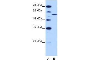 Human HepG2; WB Suggested Anti-ZRSR2 Antibody Titration: 2. (ZRSR2 抗体  (C-Term))