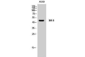 Western Blotting (WB) image for anti-Serotonin Receptor 6 (HTR6) (Internal Region) antibody (ABIN3177509) (Serotonin Receptor 6 抗体  (Internal Region))