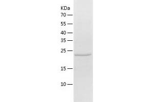 Western Blotting (WB) image for HtrA Serine Peptidase 2 (HTRA2) (AA 133-358) protein (His tag) (ABIN7284441) (HTRA2 Protein (AA 133-358) (His tag))