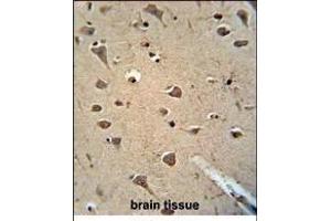 Paraformaldehyde-fixed, paraffin embedded Human brain tissue, Antigen retrieval by boiling in sodium citrate buffer (pH6. (ALDH2 抗体)