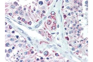 Human Testis (formalin-fixed, paraffin-embedded) stained with LIN28Bfollowed by biotinylated goat anti-rabbit IgG secondary antibody, alkaline phosphatase-streptavidin and chromogen. (LIN28B 抗体  (N-Term))