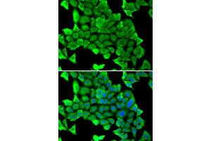 Immunofluorescence analysis of U2OS cells using MYH1 antibody (ABIN5974170). (MYH1 抗体)
