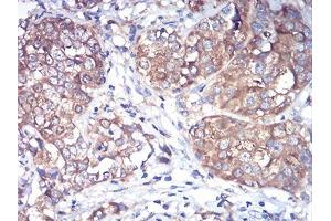 Immunohistochemistry (IHC) image for anti-RAB1B, Member RAS Oncogene Family (RAB1B) (AA 60-201) antibody (ABIN5875927) (RAB1B 抗体  (AA 60-201))
