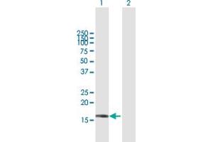 Western Blot analysis of SRP19 expression in transfected 293T cell line by SRP19 MaxPab polyclonal antibody. (SRP19 抗体  (AA 1-144))
