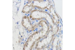 Immunohistochemistry (IHC) image for anti-Cytochrome P450, Family 51, Subfamily A, Polypeptide 1 (CYP51A1) (AA 210-509) antibody (ABIN6139370)