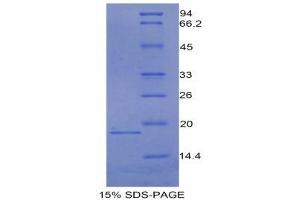 SDS-PAGE (SDS) image for Carcinoembryonic Antigen Gene Family (CEA) (AA 85-222) protein (His tag) (ABIN1980682) (CEA Protein (AA 85-222) (His tag))
