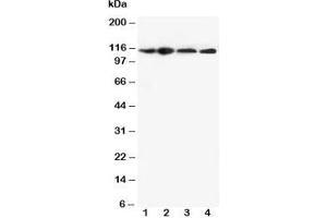 Western blot testing of NLRP3 antibody and Lane 1:  HEP-2;  2: A549;  3: U87;  4: CEM cell lysate (NLRP3 抗体  (N-Term))