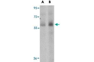 Western blot analysis of SCARB1 in human spleen tissue lysate with SCARB1 polyclonal antibody  at (A) 1 and (B) 2 ug/mL . (SCARB1 抗体  (N-Term))