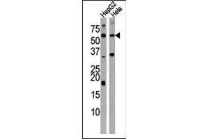 Western Blotting (WB) image for anti-Activin Receptor Type 1C (ACVR1C) (AA 33-62), (N-Term) antibody (ABIN391157)