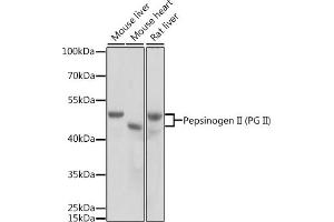 Western blot analysis of extracts of various cell lines, using Pepsinogen II (PG II) antibody (ABIN3016694, ABIN3016695, ABIN3016696 and ABIN6219816) at 1:1000 dilution. (PGC 抗体  (AA 100-200))