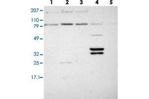 Western blot analysis of lane 1: RT-4, lane 2: EFO-21, lane 3: A-431, lane 4: Liver and lane 5: Tonsi lusing PLEK2 polyclonal antibody . (Pleckstrin 2 抗体)