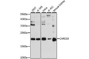 Western blot analysis of extracts of various cell lines, using CARD19 antibody (ABIN6290304) at 1:3000 dilution. (C9orf89 抗体)