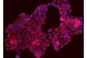 IF analysis of TOMM70 using anti-TOMM70 antibody (ABIN7599855). (TOM70 抗体  (AA 122-608))