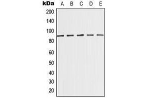 Western blot analysis of MED15 expression in MCF7 (A), K562 (B), HeLa (C), NIH3T3 (D), PC12 (E) whole cell lysates. (MED15 抗体  (Center))