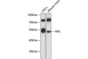 Western blot analysis of extracts of various cell lines, using ARC antibody (ABIN6131195, ABIN6137063, ABIN6137064 and ABIN6224919) at 1:3000 dilution. (ARC (AA 1-220) 抗体)