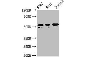 Western Blot Positive WB detected in: K562 whole cell lysate, Raji whole cell lysate, Jurkat whole cell lysate All lanes: TOX2 antibody at 4.