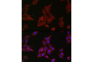 Immunofluorescence (IF) image for anti-Protein tyrosine Phosphatase, Non-Receptor Type 11 (PTPN11) antibody (ABIN7269704)