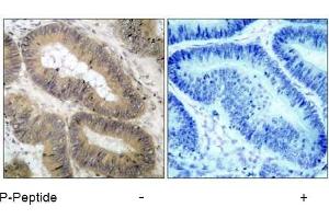 Image no. 1 for anti-conserved Helix-Loop-Helix Ubiquitous Kinase (CHUK) (pThr23) antibody (ABIN196837) (IKK alpha 抗体  (pThr23))