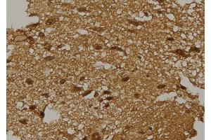 ABIN6277597 at 1/100 staining Mouse brain tissue by IHC-P.