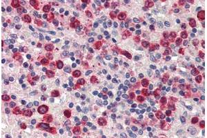 Human Spleen (formalin-fixed, paraffin-embedded) stained with ZBTB7A antibody ABIN337217 at 2. (ZBTB7A 抗体  (C-Term))