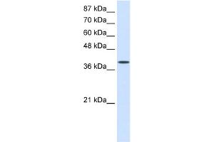 WB Suggested Anti-EIF4G2 Antibody Titration:  0. (EIF4G2 抗体  (C-Term))
