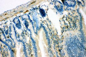 Anti- IRS1 antibody, IHC(P) IHC(P): Mouse Intestine Tissue (IRS1 抗体  (AA 1041-1242))