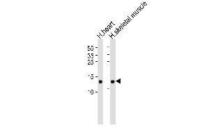 Western blot analysis of lysates from human heart and skeletal muscle tissue lysate(from left to right), using FABP3 Antibody (ABIN6242886 and ABIN6577405).