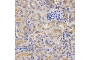 Immunohistochemistry of paraffin-embedded mouse kidney using CFB antibody at dilution of 1:200 (x400 lens) (Complement Factor B 抗体  (AA 80-420))