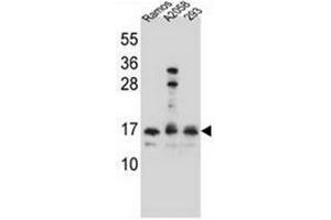 Western blot analysis of Homeodomain-only protein / HOP Antibody  in Ramos,A2058,293 cell line lysates (35ug/lane). (HOPX 抗体  (C-Term))