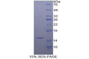 SDS-PAGE (SDS) image for Inhibin, beta A (INHBA) (AA 311-426) protein (His tag) (ABIN1877730) (INHBA Protein (AA 311-426) (His tag))