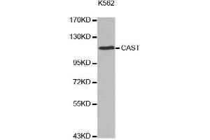 Western blot analysis of extracts of K562 cell line, using CAST antibody. (Calpastatin 抗体  (C-Term))