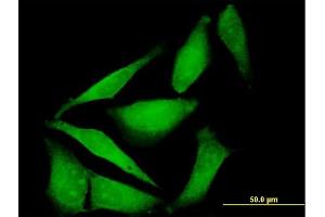 Immunofluorescence of purified MaxPab antibody to FBXO40 on HeLa cell. (FBXO40 抗体  (AA 1-709))