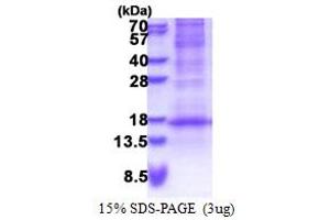 SDS-PAGE (SDS) image for Defensin, beta 116 (DEFB116) (AA 24-102) protein (His tag) (ABIN5853310) (DEFB116 Protein (AA 24-102) (His tag))