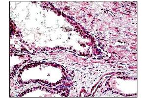 Human Prostate: Formalin-Fixed, Paraffin-Embedded (FFPE) (STEAP2 抗体  (AA 455-467))