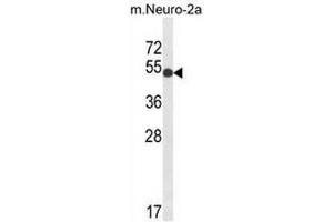 Western blot analysis of GPI Antibody (C-term) in mouse Neuro-2a cell lysates (35µg/lane). (GPI 抗体  (C-Term))