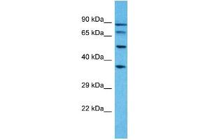Western Blotting (WB) image for anti-Pseudouridylate Synthase 7 Homolog-Like (PUS7L) (N-Term) antibody (ABIN2791889) (PUS7L 抗体  (N-Term))