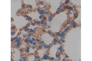 IHC-P analysis of Mouse Tissue, with DAB staining. (FCGR1 抗体  (AA 73-294))