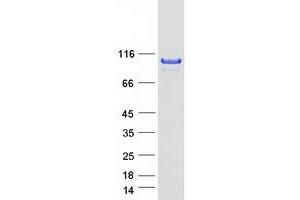 Validation with Western Blot (ABR Protein (Transcript Variant 1) (Myc-DYKDDDDK Tag))