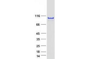 Validation with Western Blot (ABR Protein (Transcript Variant 1) (Myc-DYKDDDDK Tag))