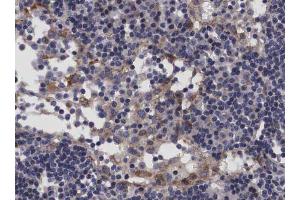 ABIN6266689 at 1/100 staining human Lymph node tissue sections by IHC-P. (TP53I11 抗体  (N-Term))