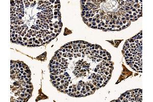 DHX32 Antibody at 1/100 staining mouse testis tissue by IHC-P. (DHX32 抗体)