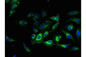 Immunofluorescent analysis of Hela cells using ABIN7173241 at dilution of 1:100 and Alexa Fluor 488-congugated AffiniPure Goat Anti-Rabbit IgG(H+L) (TMEM56 抗体  (AA 232-263))